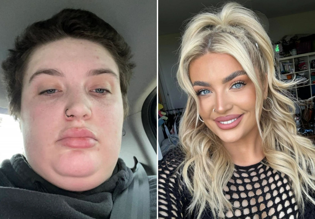 Njena transformacija oduševila svet: "Smršala sam više od 40 kilograma, ljudi me više ne prepoznaju’