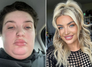 Njena transformacija oduševila svet: "Smršala sam više od 40 kilograma, ljudi me više ne prepoznaju’