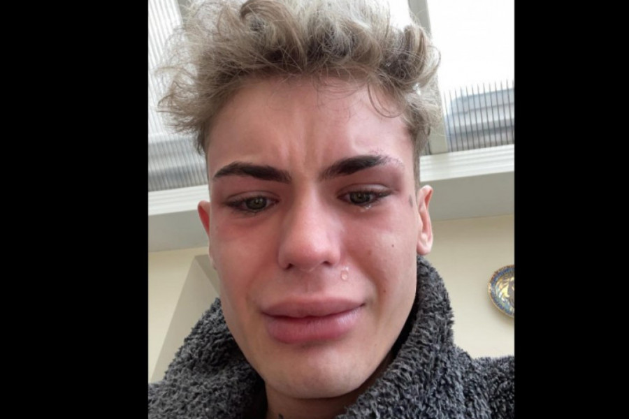 Platio sam 500.000 dinara da uradim zube u Turskoj: Sada izgleda kao ajkula