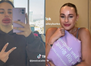 Da li je ovo ista osoba? Dobila je besplatno uvećavanje usana, a onda joj se život pretvorio u pakao