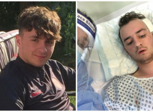 Javio se lekaru zbog upale uha: Mesec dana kasnije, tinejdžeru nije bilo pomoći