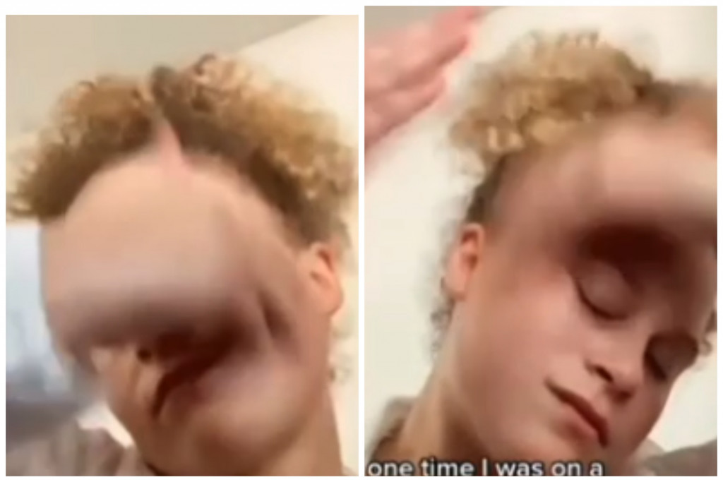 Zvuči suludo, ali je učinkovito: Žene se šamaraju po licu po 50 puta dnevno, a efekat je "vau"