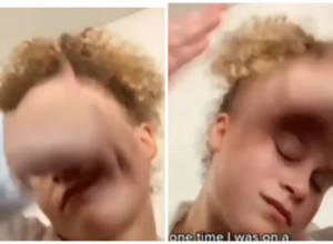 Zvuči suludo, ali je učinkovito: Žene se šamaraju po licu po 50 puta dnevno, a efekat je "vau"