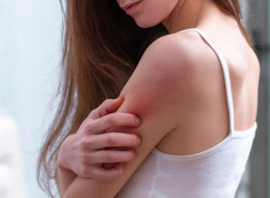 Tri prirodne metode za odbranu od komaraca: Jeftino, zdravo i nikad se toga ne biste setili, a rešićete se dosadnih insekata