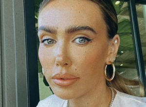 „Srećna sam što sam živa“: Drama bogate naslednice Petre Eklston, zbog greške zubara doživela horor