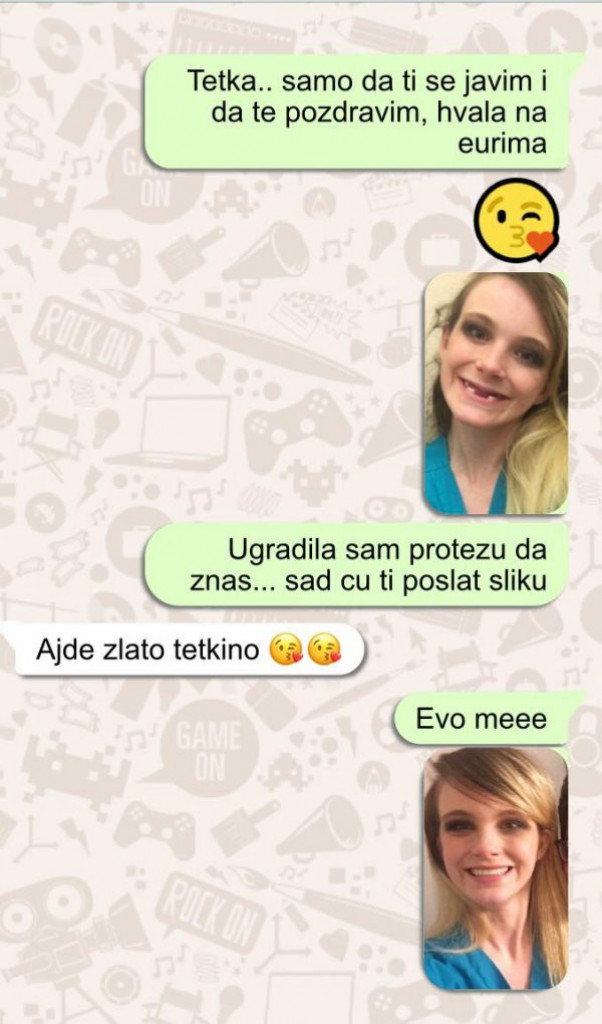 Tetka iz Nemačke mi je poslala 500 evra da uradim protezu: Bila sam ružna, svi su mi se smejali - a pogledajte me sada