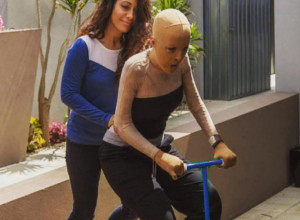 Prelepu Srpkinju ljubomorna žena živu zapalila: Imala preko 200 operacija, a danas niko ne veruje kako izgleda