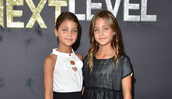 Majku kritikuju da su joj ćerke tužne dok poziraju: Najlepše bliznakinje na svetu su porasle, a evo kako danas izgledaju