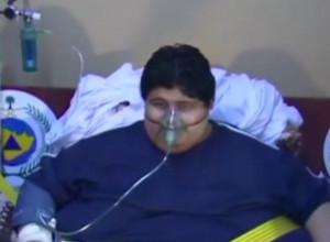 "Najteži tinejdžer" na svetu sada je neprepoznatljiv: Iz kuće ga izneli viljuškarom, da bi za četiri godine smršao 548 kilograma
