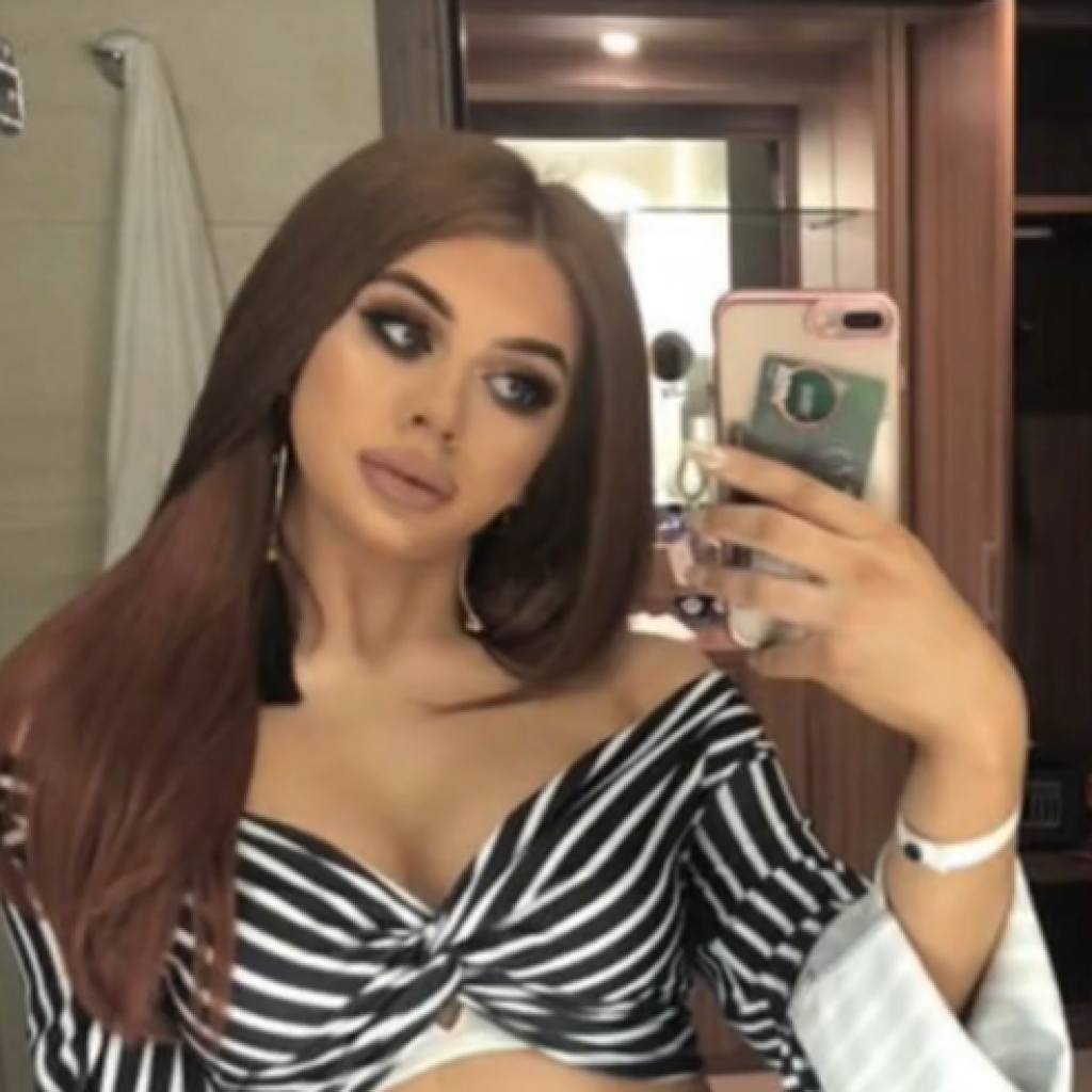 Ljudi su oduševljeni njenom transformacijom: Izvadila je sve filere, izgleda potpuno drugačije