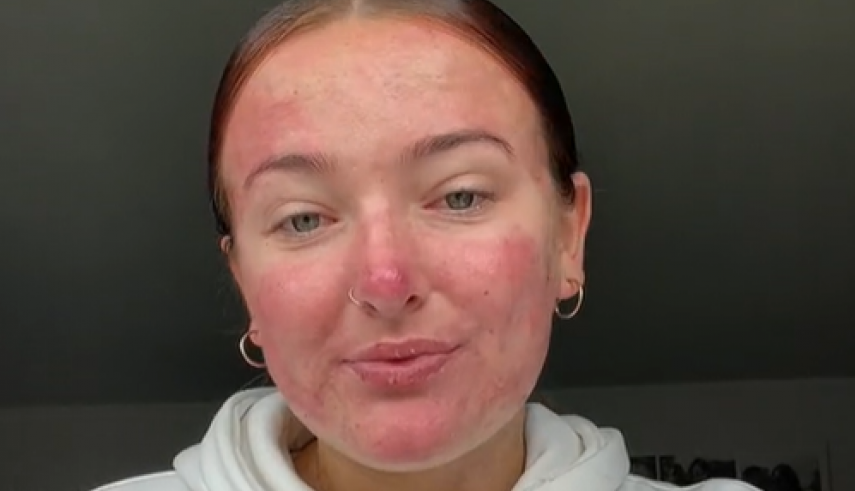 Godinama je vršnjaci maltretirali zbog izgleda: Odlučila je da pokaže svetu pravo lice, ljudi je masovno podržavaju