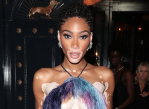 Vitiligo devojka odnela šou na crvenom tepihu: Manekenka Vini Harlou pokazala zategnuto telo u minijaturnoj haljini