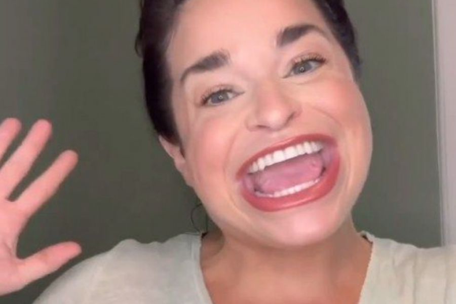 Nije fotošop: Sem ima najveća usta na svetu, nekada se stidela, a sada se smeje od uva do uva!