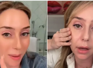 Dermatološkinja tvrdi da zato izgledamo starije: Ove tri greške žene prave u nezi kože nakon 30. godine