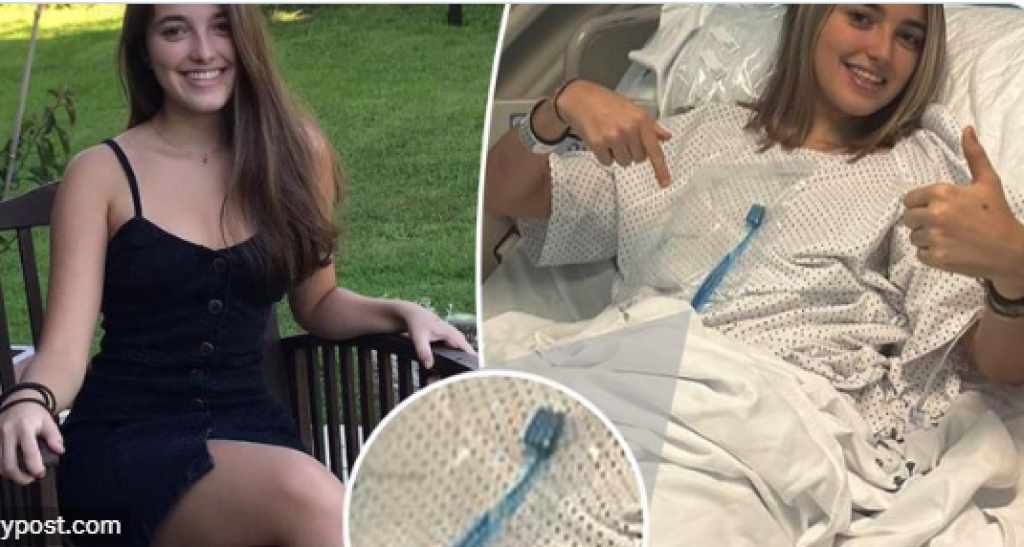 Doktori se našli u čudu: Devojka (21) se gušila ćuretinom, a onda je progutala i četkicu za zube