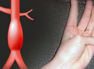 Doktori apeluju: Test sa palcem kao skener  - Za ovu podmuklu bolest nekoliko sekundi pravi razliku između života i smrti