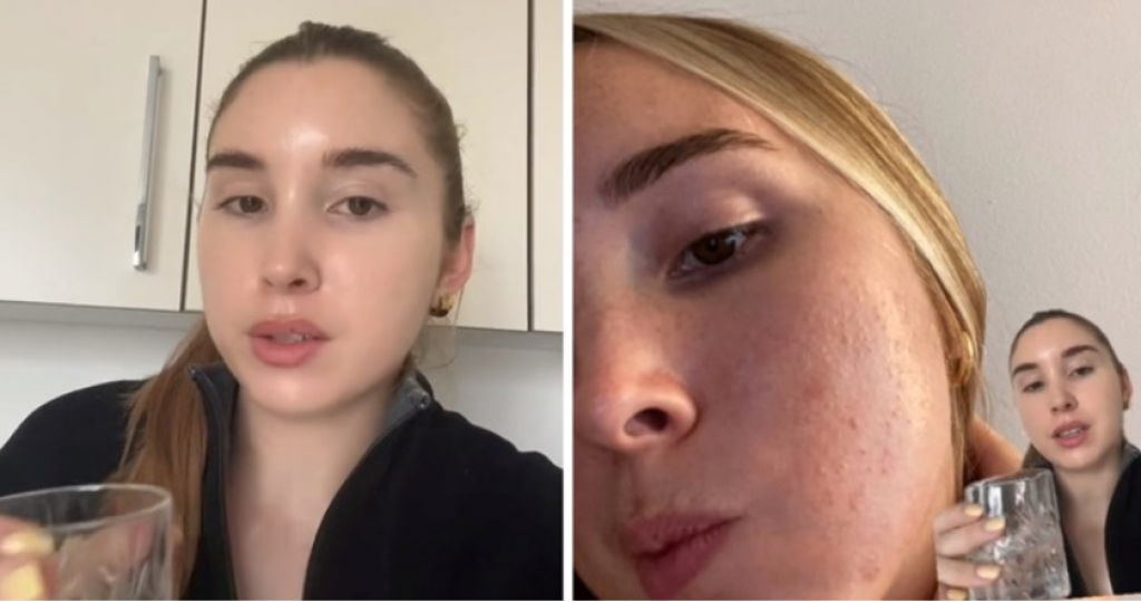 Minimalistička nega kože je sve više u trendu: Dermatolog dala zlata vredan savet kako treba da izgleda bjuti rutina