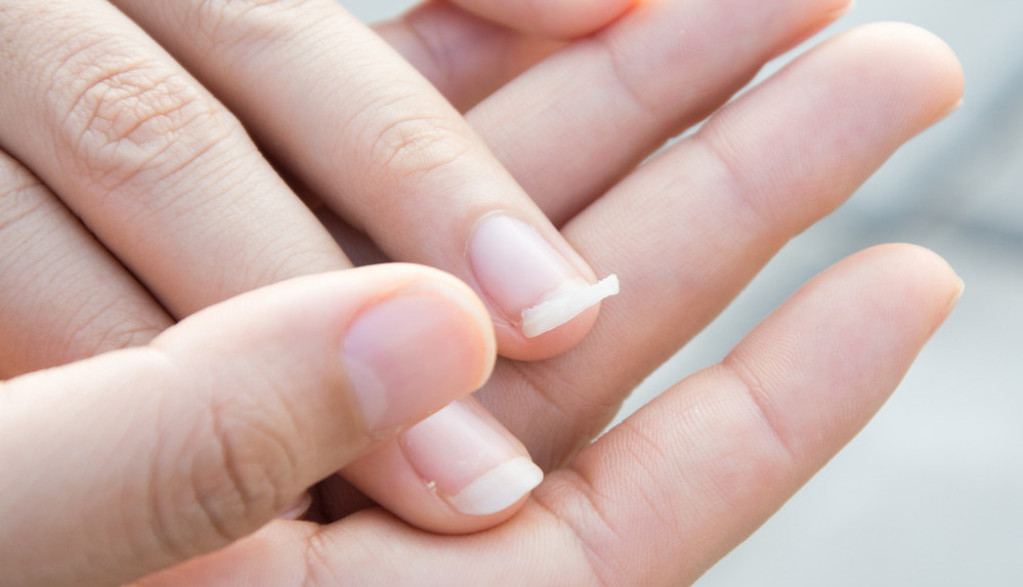 Ako vam nokti stalno pucaju, probajte ovu metodu: Žene kažu da provereno radi, a sve sastojke za nju već imate u kući