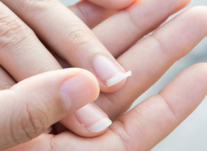 Ako vam nokti stalno pucaju, probajte ovu metodu: Žene kažu da provereno radi, a sve sastojke za nju već imate u kući