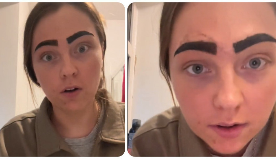 Zaspala usred bjuti tretmana: Kada se probudila zaplakala je od muke, njeno lice bilo je unakaženo