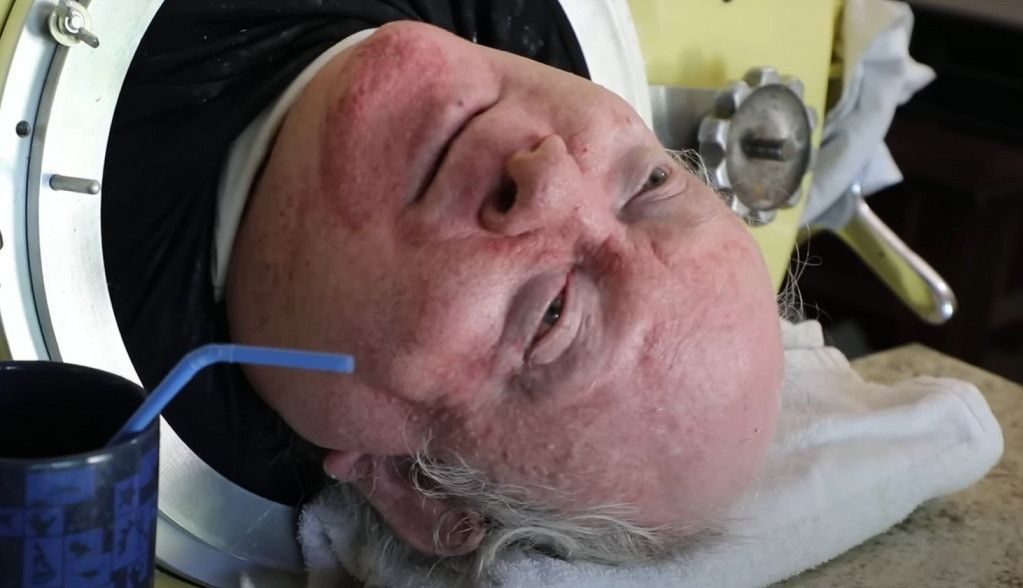 Svim bolesnima je bio uzor: Preminuo čovek koji je živeo 70 godina u kutiji s čeličnim plućima, a sve vreme radio i pisao knjige!