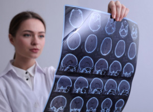 Ove namirnice dovode do upale u mozgu: Doktori otkrili šta treba da izbacite iz ishrane, za jedno će se svi iznenaditi