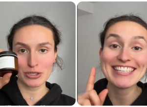 Viralni trend nege kože goveđim lojem zaludeo bjuti svet: Evo šta o tome kažu dermatolozi