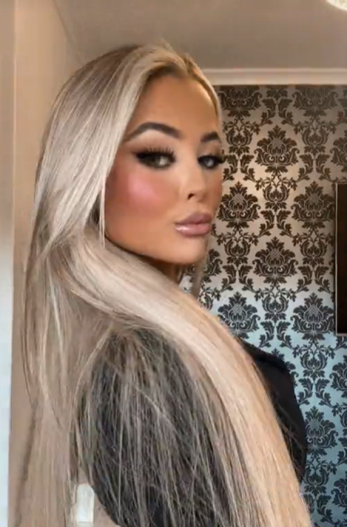 Zapanjila svojom transformacijom: Devojka je skinula nadogradnju i trepavice, izvadila filere, evo kako sada izgleda