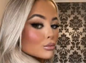 Zapanjila svojom transformacijom: Devojka je skinula nadogradnju i trepavice, izvadila filere, evo kako sada izgleda