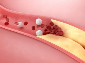 Jedite i gledajte šta se dešava: Nutricionista preporučuje ukusne namirnice za snižavanje holesterola