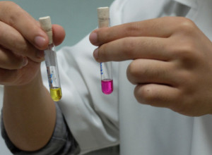 Može da izazove maligne bolesti ako se zanemari: Dr Tarabar o lečenju heliko bakterije i zašto je soda bikarbona opasna