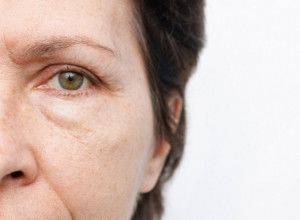 Ne jedete dovoljno vlakana: Pet grešaka u ishrani koje izazivaju natečenost i kesice oko očiju