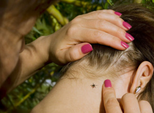 Šta da radite ako vas uјеde кrpеlj? Kako da prepoznate simptome i izvadite ga iz kože