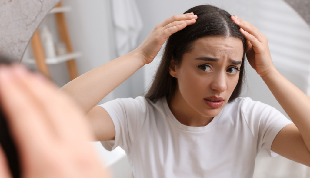 Kosa zahteva posebnu negu: Piling temena od dva sastojka koja imate u kuhinji oduševio žene