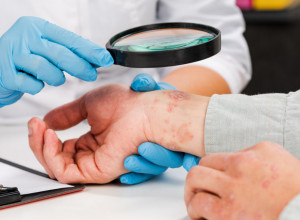 Naučnici došli do napretka: Identifikovali mogući uzrok lupusa, od koga boluje 5 miliona ljudi širom sveta