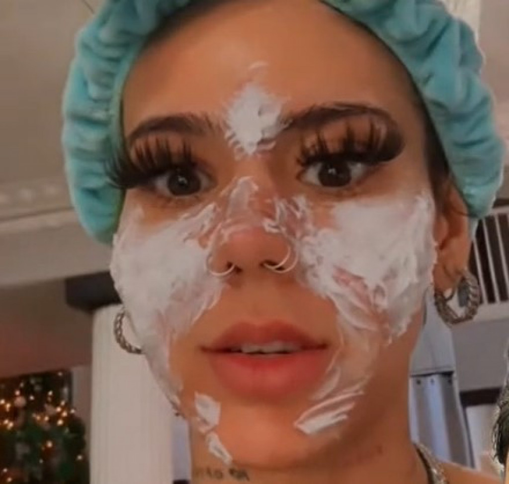 Upropastila se: Žena je namazala kremu kojoj je istekao rok trajanja, lice joj je sada katastrofalno!