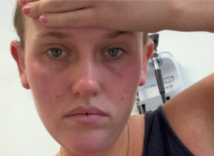 ,,Dobila sam osip po celom telu": Emi se putovanje iz snova pretvorilo u najgoru noćnu moru, a za sve je kriv virus koji se širi Evropom