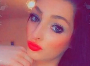 Devojka (24) je preživela pakao: Sve je počelo od žulja na stopalu, na kraju su joj odsekli nogu!