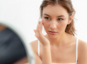 Izgorela je na suncu, a  svekrvin trik ju je spasao za pola sata: Reč je o proizvodu koji svi imamo, a nije kiselo mleko