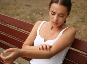 Zamka koja čak lepo miriše, a komarci beže od nje kao đavo od krsta: Trebaju vam 3 sastojka, imate ih sigurno u kući