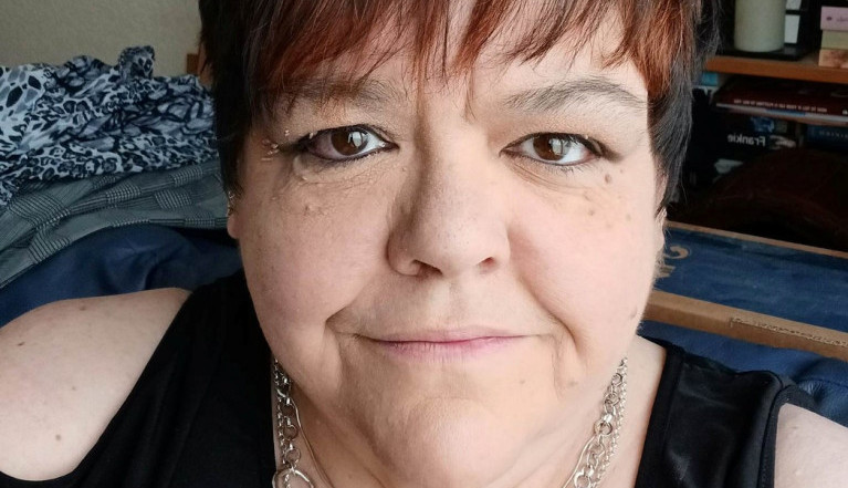 Silvija je 8 dana bila u komi zbog brushaltera: Napala je bakterija "koja jede meso", jedva je preživela