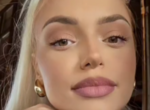 Rekla sam momku Crnogorcu da bih povećala usne: Šta mislite, kako je on reagovao?