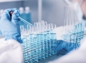 Istraživanje otkriva: Smrtnost od raka će porasti 93 odsto do 2050. godine, jedna grupa ljudi je najugroženija