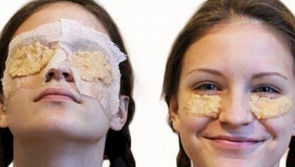 Jeftino, a začas licu vraća svežinu: Otkriven tajni recept za brzo zatezanje bora i brisanje podočnjaka