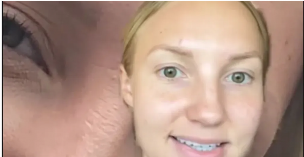 Rešila se bora bez botoksa: Nimalo truda nije uložila u to, a evo koje korake je preduzela  kako bi uklonila znakove starenja