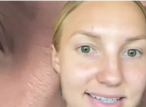 Rešila se bora bez botoksa: Nimalo truda nije uložila u to, a evo koje korake je preduzela  kako bi uklonila znakove starenja
