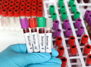 Ove 4 namirnice najpozitivnije utiču na poboljšanje krvne slike: Rešite se glavobolje, tahikardije, malaksalosti...