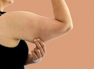 Izmerite obim svoje nadlaktice: Ako je veći od ovog broja, to može da ukaže na smrtonosne bolesti