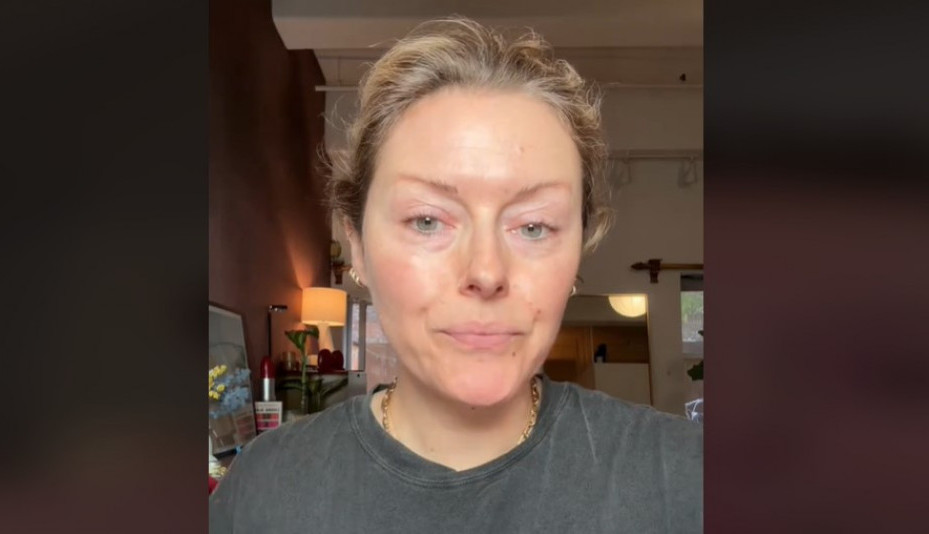 Umesto botoksa, žene masovno koriste jedno voće: Tvrde da zateže kožu lica i ublažava bore, a evo šta kažu dermatolozi