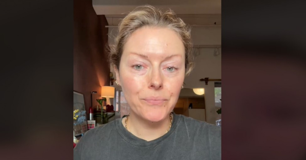 Umesto botoksa, žene masovno koriste jedno voće: Tvrde da zateže kožu lica i ublažava bore, a evo šta kažu dermatolozi